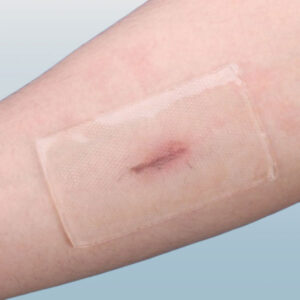 Silicone Scar Removal Tape